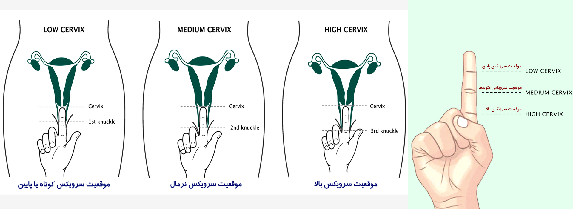 کاپ قاعدگی حورا